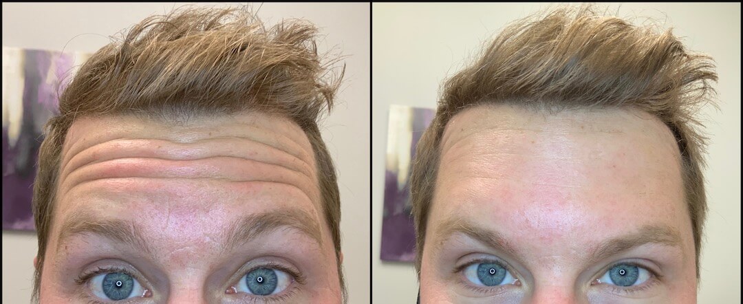 Before & After Medical Spa Treatment